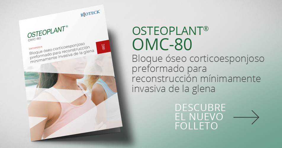 OMC-80