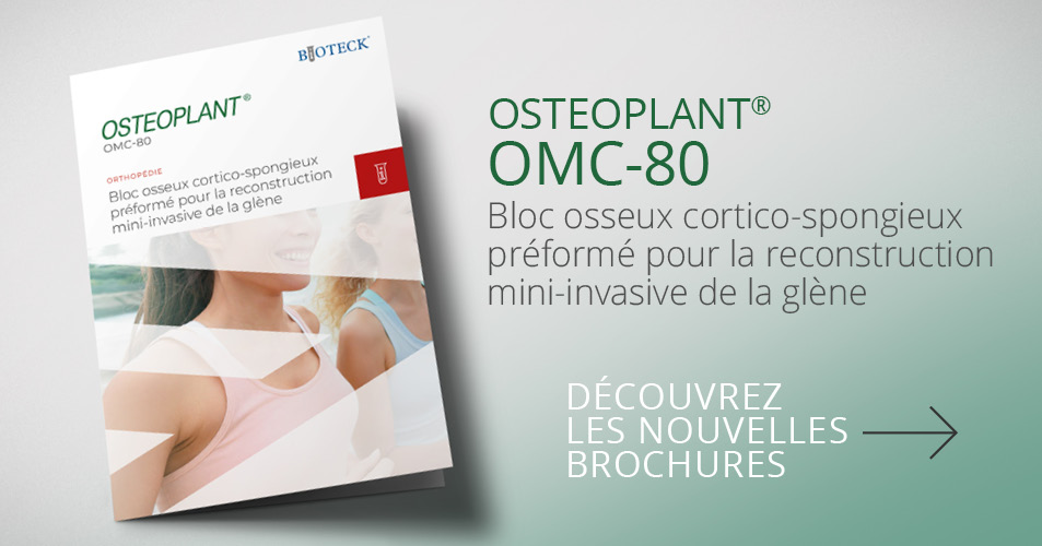 OMC-80