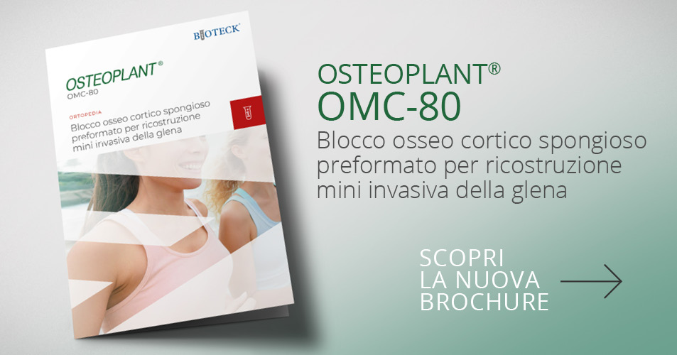 OMC-80